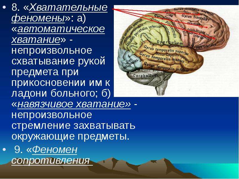 Нарушение коры. Центральный отдел вестибулярного анализатора. Корковый центр вестибулярного анализатора. Локализация речевых функций в коре головного мозга. Корковый отдел головной мозг анализатора.