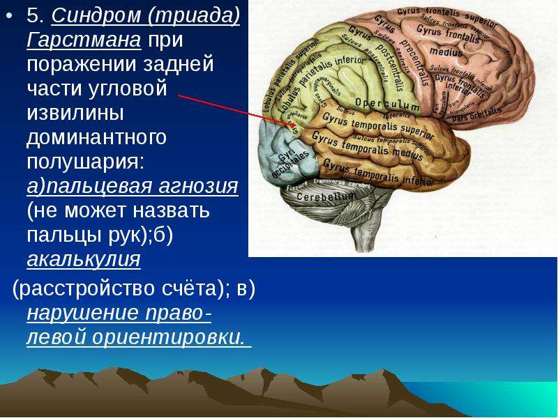 Поражение полушария