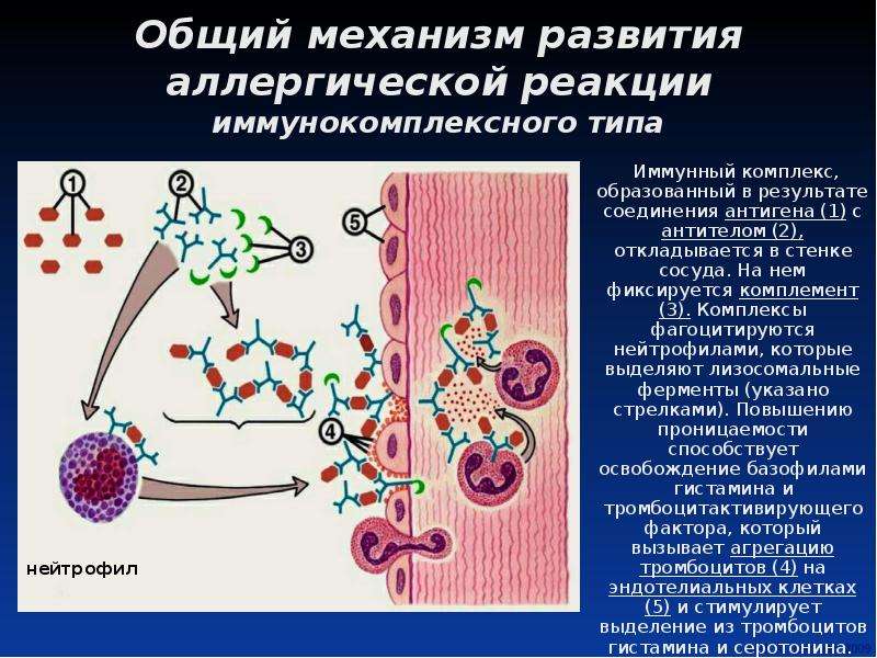 Компонент аллергической реакции. Механизм развития аллергического процесса иммунология. Механизм развития аллергической реакции. 1. Иммунологические механизмы аллергических реакций.. Иммунологическая стадия аллергической реакции.