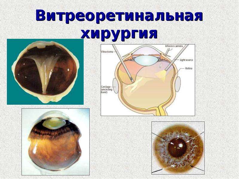 Презентация история офтальмологии