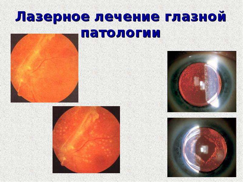 Презентация история офтальмологии