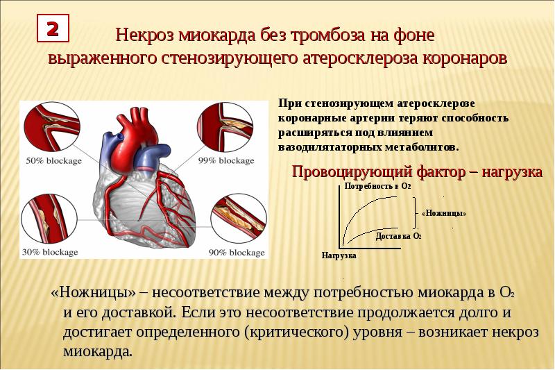 Аортальная недостаточность презентация