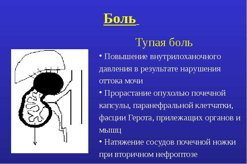 Опухоли патанатомия презентация