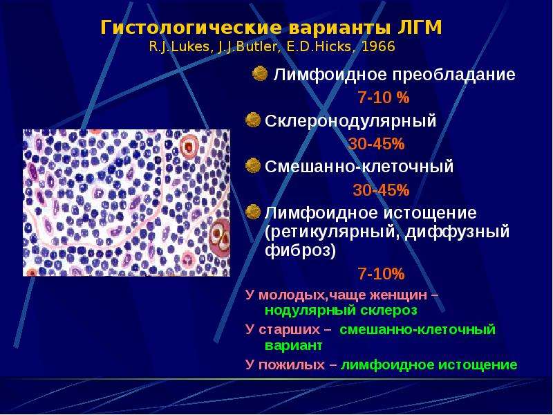 Презентация на тему лимфома