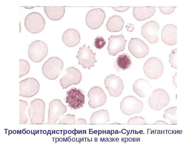 Тромбоциты в мазке крови фото