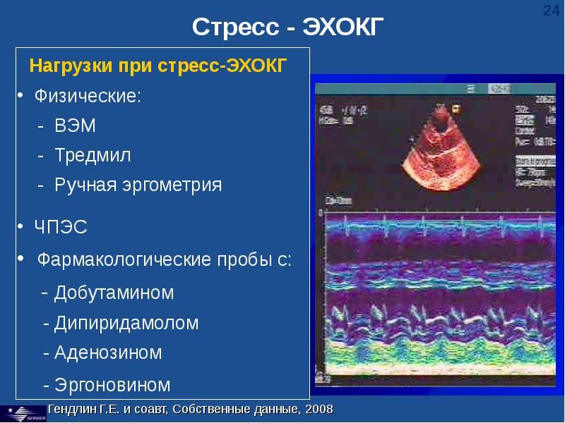 Эхокардиография сердца презентация