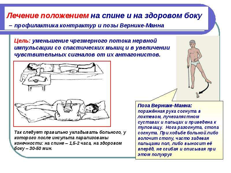 Реабилитация при онмк презентация