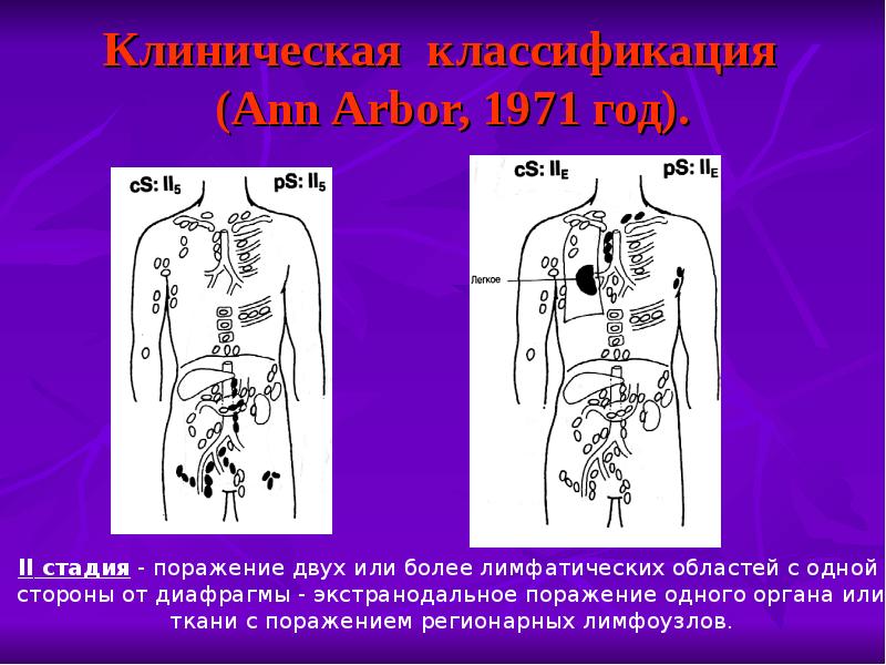 Злокачественные новообразования кожи презентация