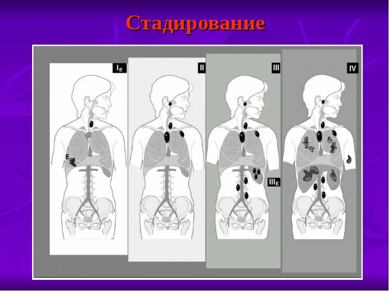 Злокачественные новообразования кожи презентация