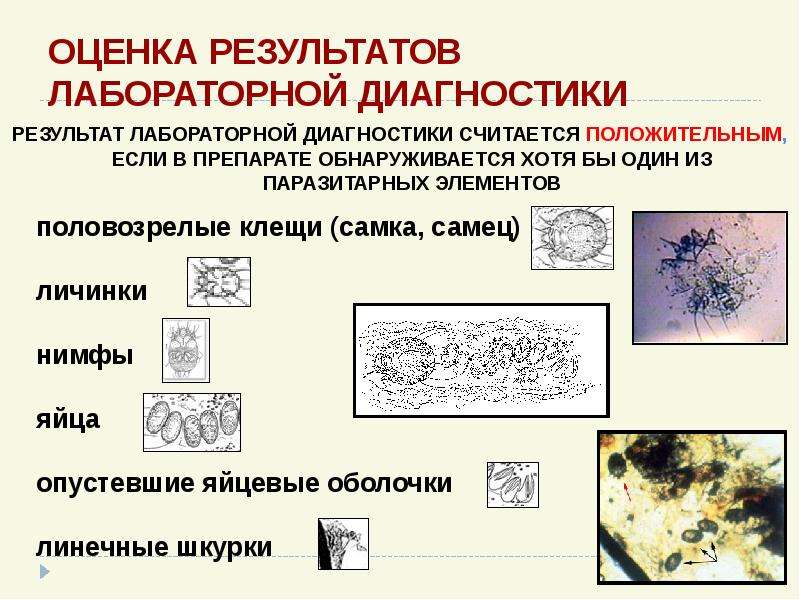 Презентация на тему чесотка