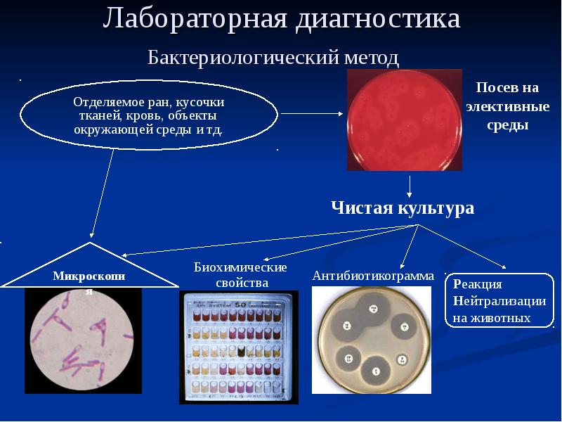 Культура диагностики. Антибиотикограммы. Антибиотикограмма микробиология метод. Учет результатов антибиотикограммы. Кассетная антибиотикограмма.