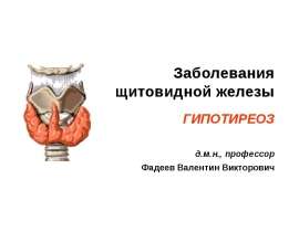 Тироидиты. Сндром гипотиреоза