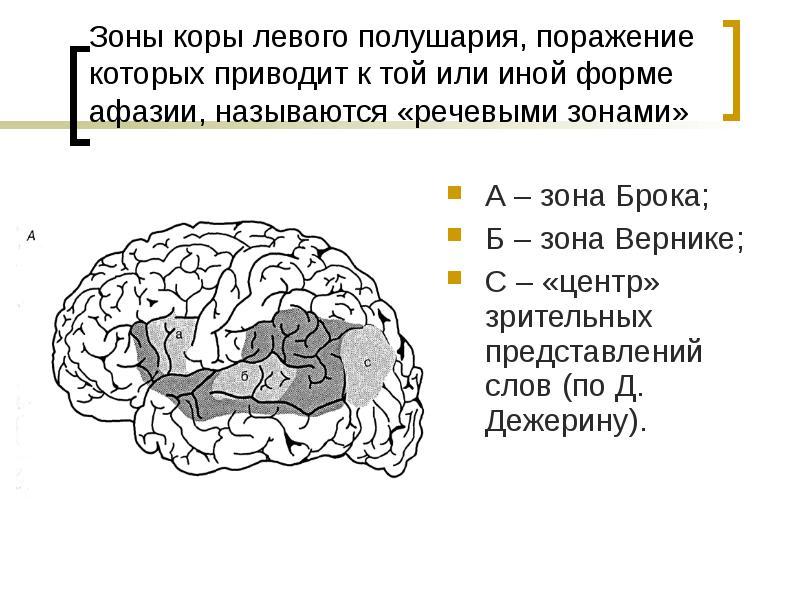 Этиология афазии