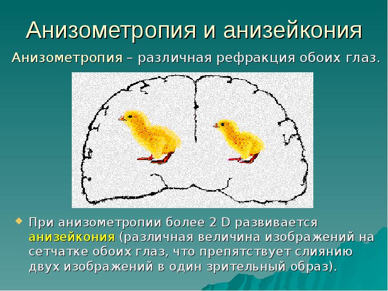 Ретинальное изображение это в психологии