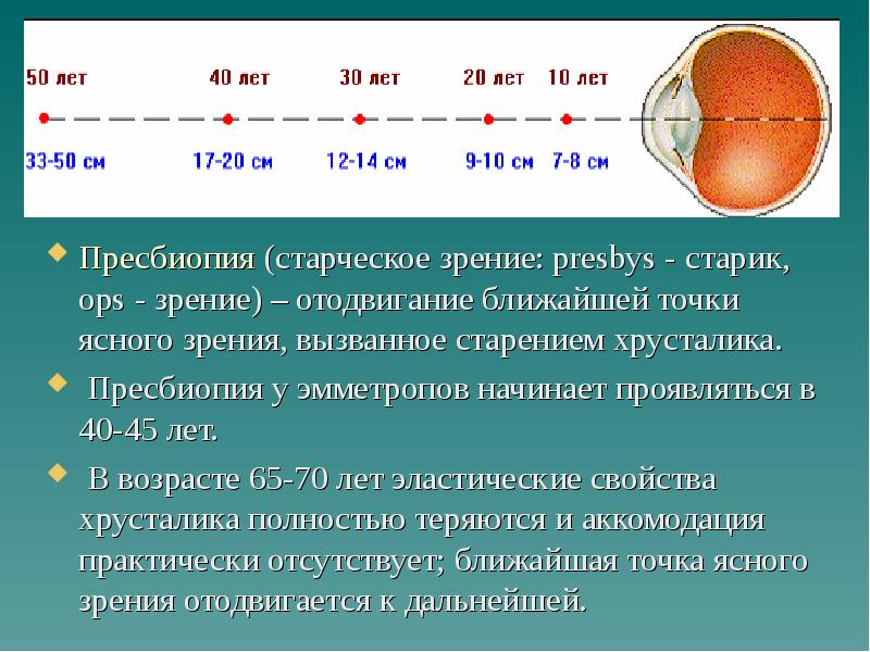 Формула рефракции. Пресбиопия. Пресбиопия (возрастная дальнозоркость). Ближайшая точка ясного зрения при пресбиопии.