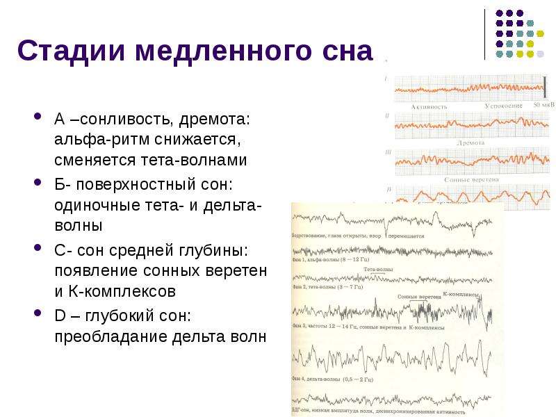 Поверхностный сон. Сонные веретена и к-комплексы на ЭЭГ. Медленный Альфа ритм на ЭЭГ. Веретена на ЭЭГ. Фаза медленного сна.