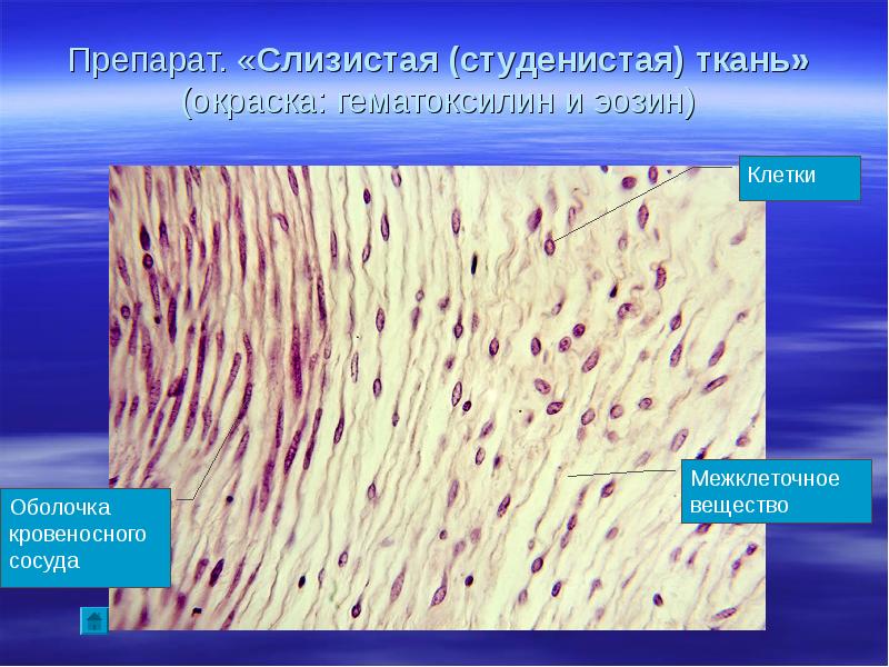 Межклеточное вещество функции и строение клеток. Студенистая соединительная ткань гистология. Слизистая соединительная ткань гистология. Слизистая ткань гистология препарат. Слизистая волокнистая соединительная ткань.