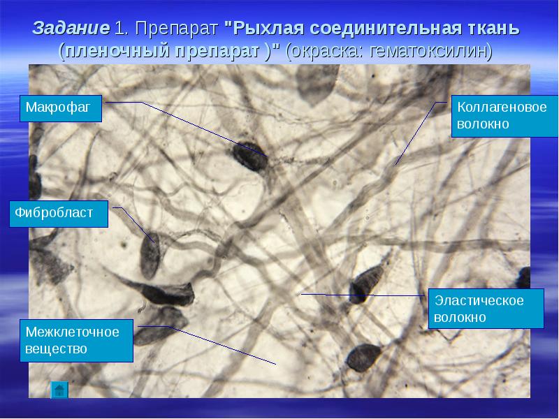 Рыхлая волокнистая неоформленная соединительная ткань рисунок с подписями