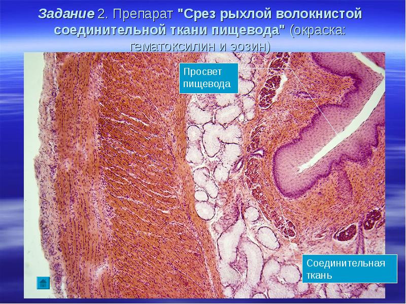 Соединительная ткань рниму презентация