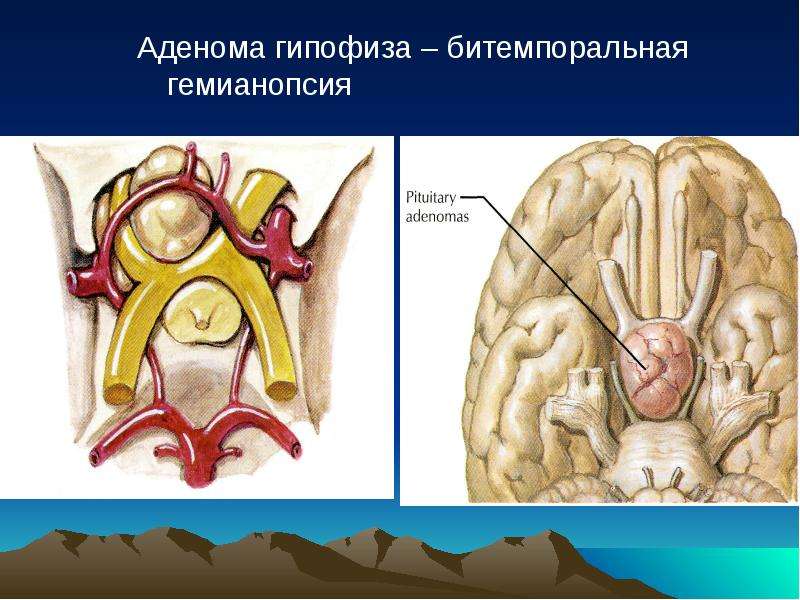 Подглазничный нерв картинка