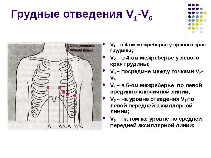 Правые отведения. ЭКГ грудные отведения точки. В грудных отведениях электроды располагаются. ЭКГ сердца грудные отведения. Грудные отведения ЭКГ схема.