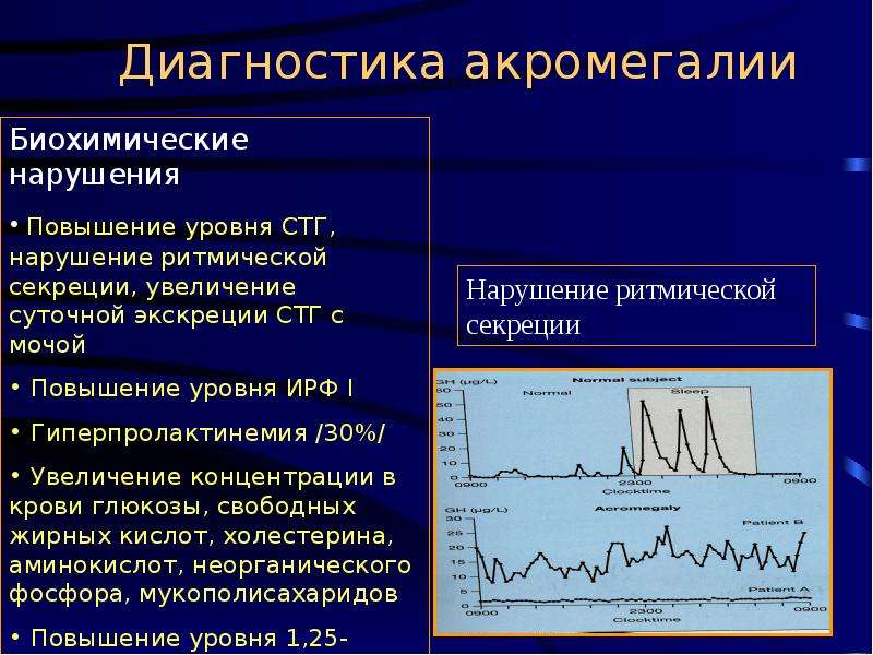 Диагностика акромегалии презентация