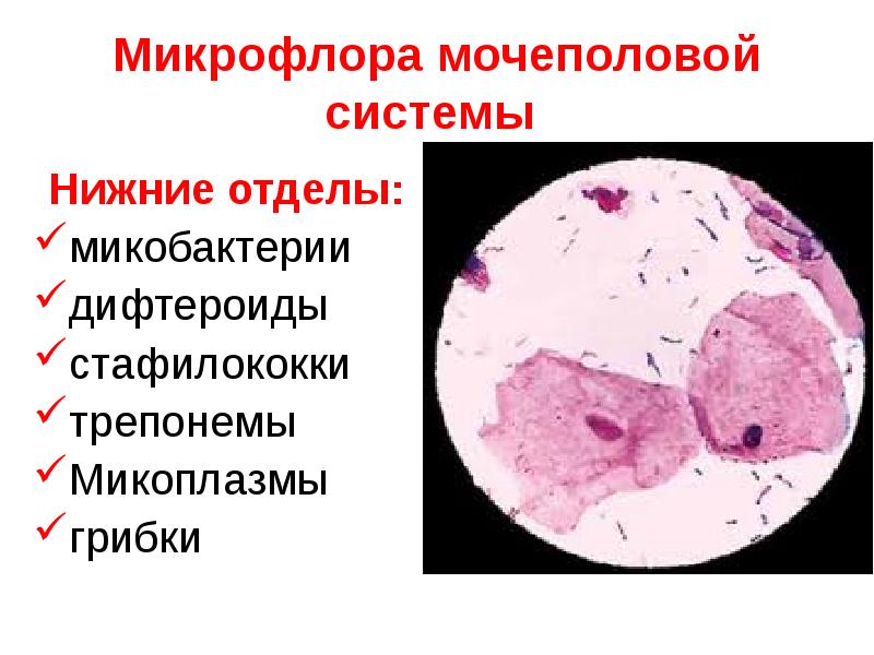   Микрофлора мочеполовой системы 
Нижние отделы:
микобактерии
дифтероиды
стафилококки
трепонемы
Микоплазмы
грибки
