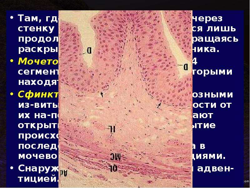 Трабекулярная стенка мочевого