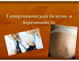 Гипертоническая болезнь и беременность
