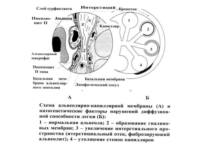 Патофизиология дыхания презентация