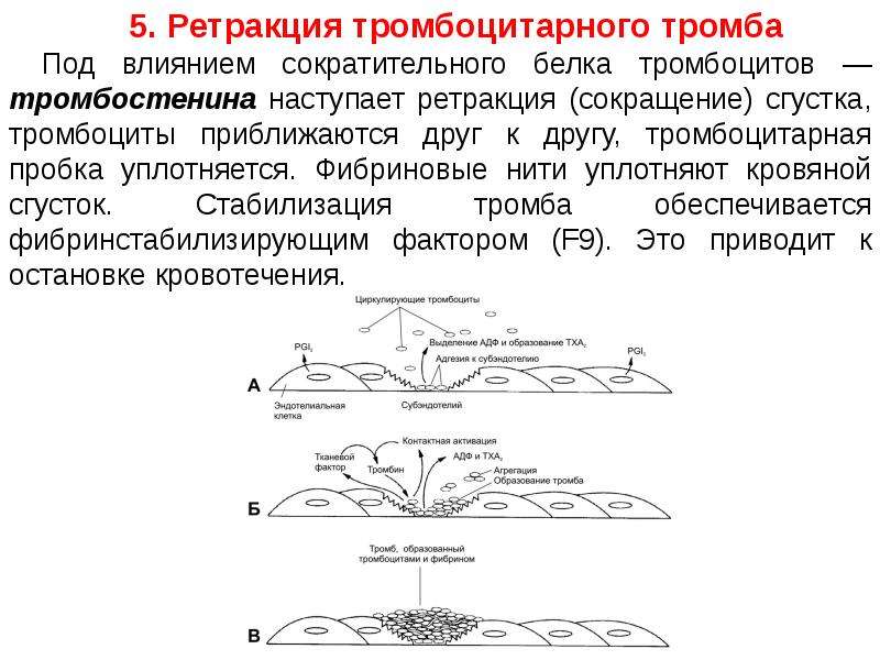 Ретракция. Ретракция кровяного сгустка физиология. Ретракция тромбоцитарного тромба. Ретракция тромбоцитарного сгустка. Ретракция тромба это в физиологии.