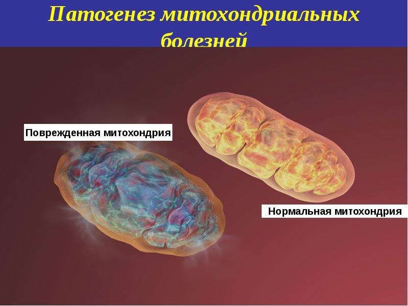 Митохондриальные болезни презентация