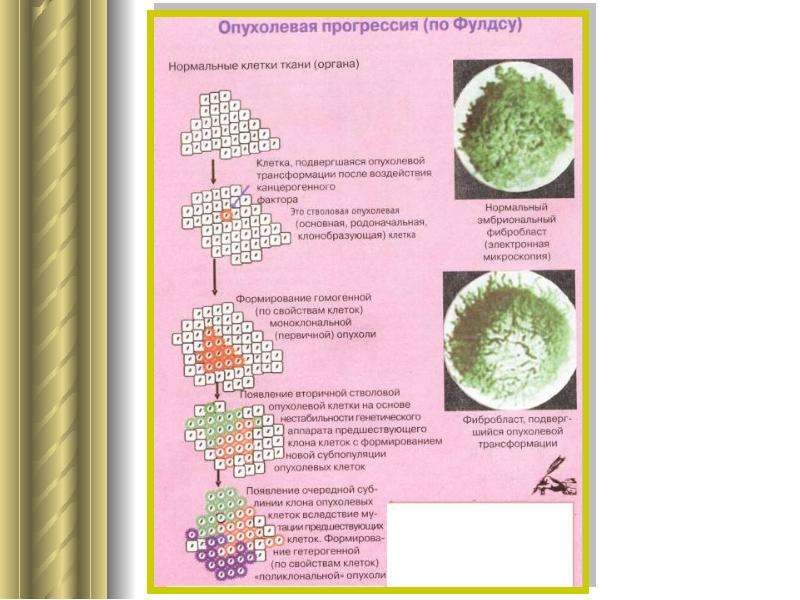 Патофизиология опухолевого роста презентация