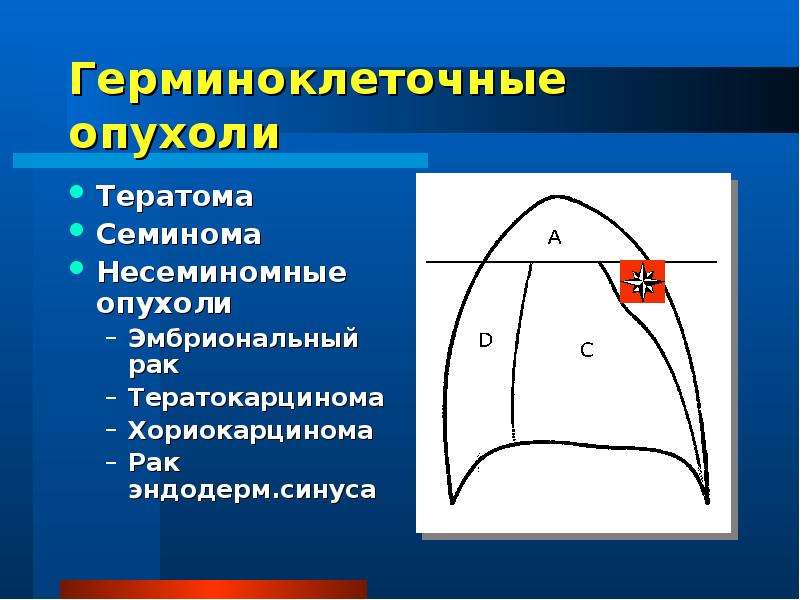 Кисты средостения презентация