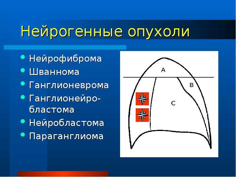 Злокачественные опухоли средостения. Опухоли и кисты средостения. Образования переднего средостения. Опухоль заднего средостения. Образования заднего средостения.