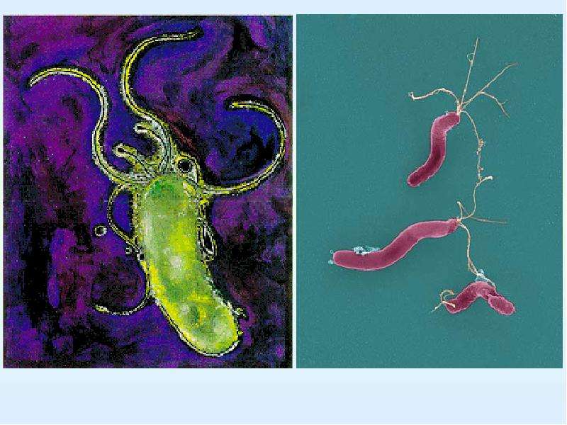 Продукты убивающие хеликобактер. Helicobacter pylori бактериофаги. Хеликобактер пилори рн3. Хеликобактер пилори одноклеточный?. Темнопольная микроскопия хеликобактер пилори.