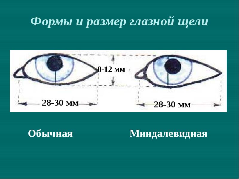 Схема строения глазной щели