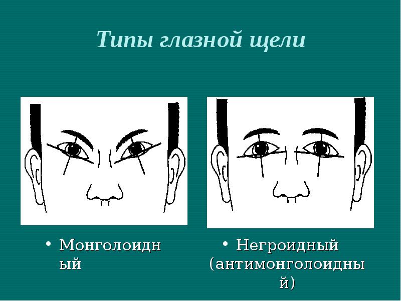 Глазная щель. Типы глазной щели. Антимонголоидный разрез глазных щелей. Форма глазной щели. Монголоидный Тип глазной щели.