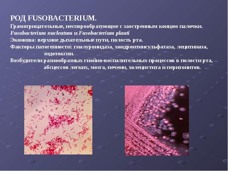 Анаэробные условно патогенные. Фузобактерия нуклеатум. Фузобактерии морфология. Fusobacterium nucleatum (палочка Плаута). Фузобактерии классификация.