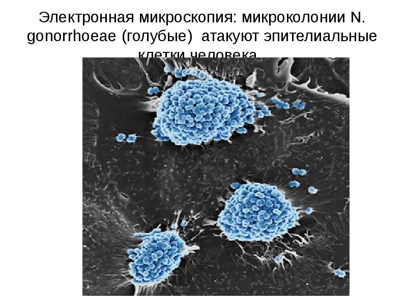 Урогенитальный хламидиоз презентация