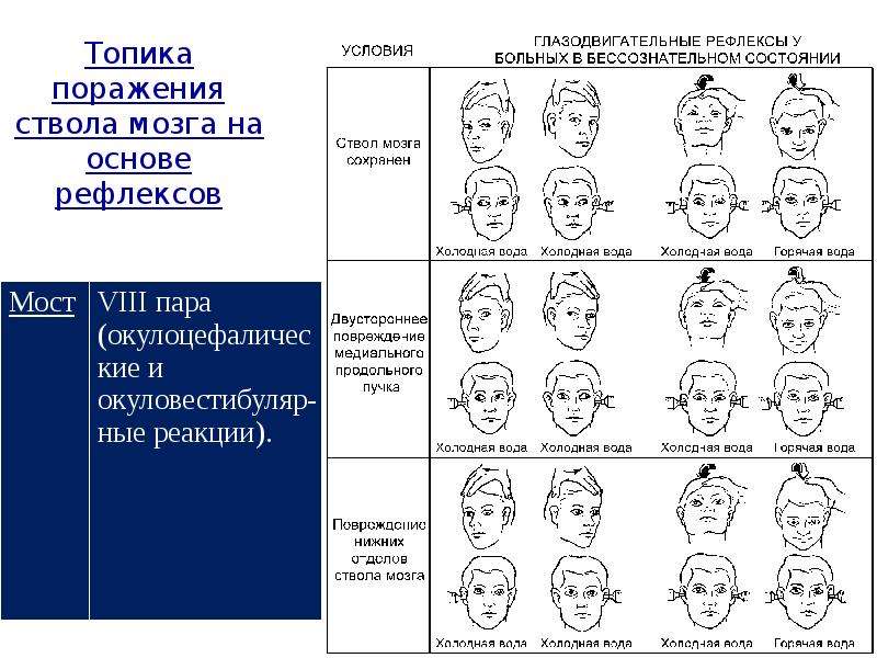 Топика поражения это. Топика поражения лицее.