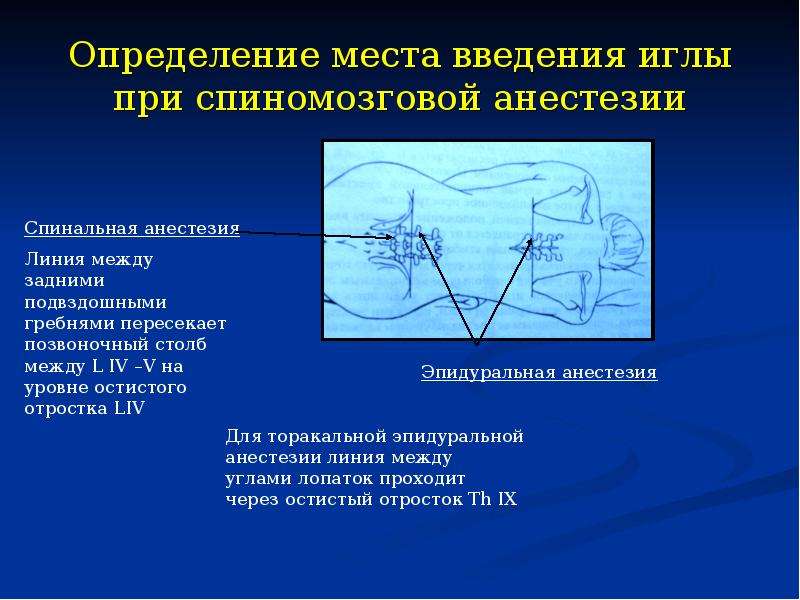 Мультимодальная анестезия презентация