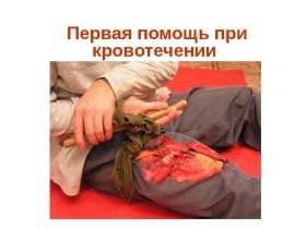 ПЕРВАЯ ПОМОЩЬ ПРИ КРОВОТЕЧЕНИИ И ТРАВМАТИЧЕСКОМ ШОКЕ