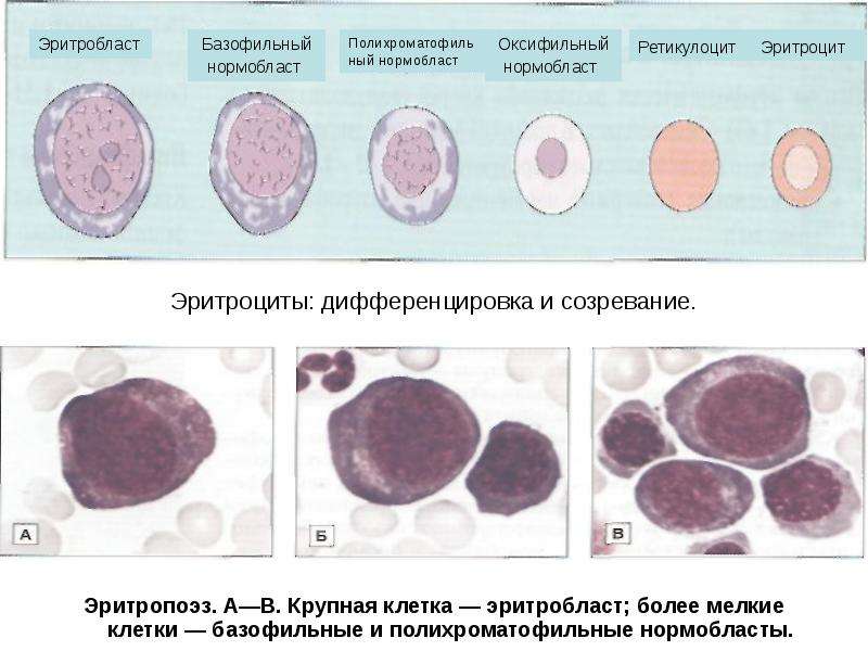 Нормобласты в крови картинки