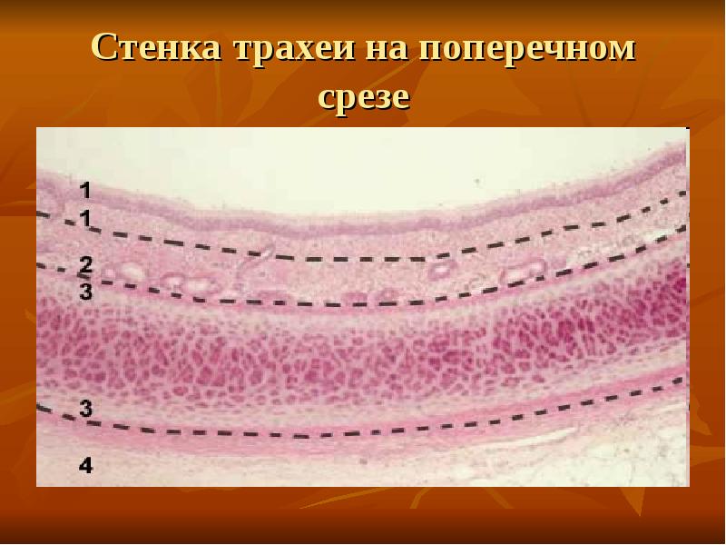 Стенка трахеи состоит из следующих слоев