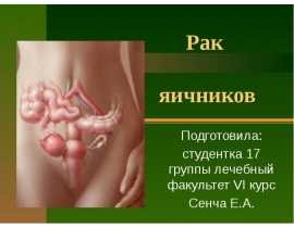 Рак яичников