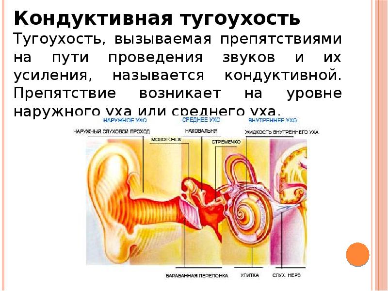 Приобретенная глухота. Глухота презентация. Тугоухость и глухота. Тугоухость и глухота презентация. Кондуктивная тугоухость.