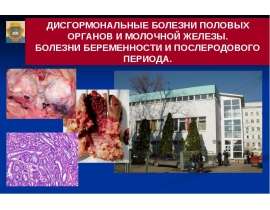 Дисгормональные болезни половых органов