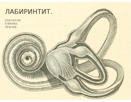 Лабиринтит. ЭТИОЛОГИЯ. КЛИНИКА. ЛЕЧЕНИЕ.