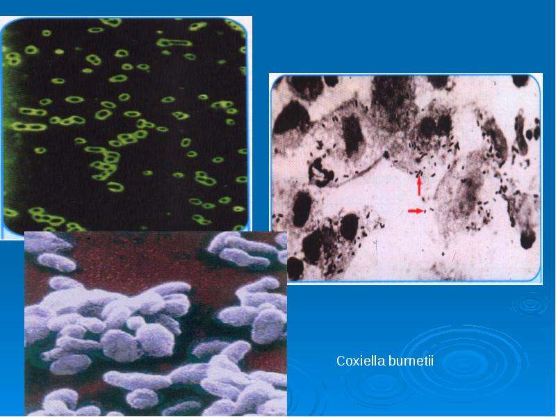 Коккобациллы что это. Риккетсии Coxiella. Риккетсии Бернета. Возбудители коксиеллеза. Коксиеллы микробиология.